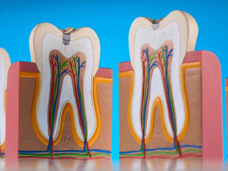 虫歯治療のご相談は北浦和の歯医者『PONOデンタルクリニック北浦和』